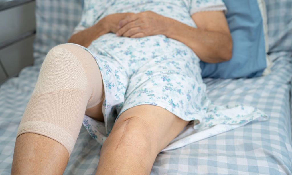 What to Expect 5 Months After Knee Replacement